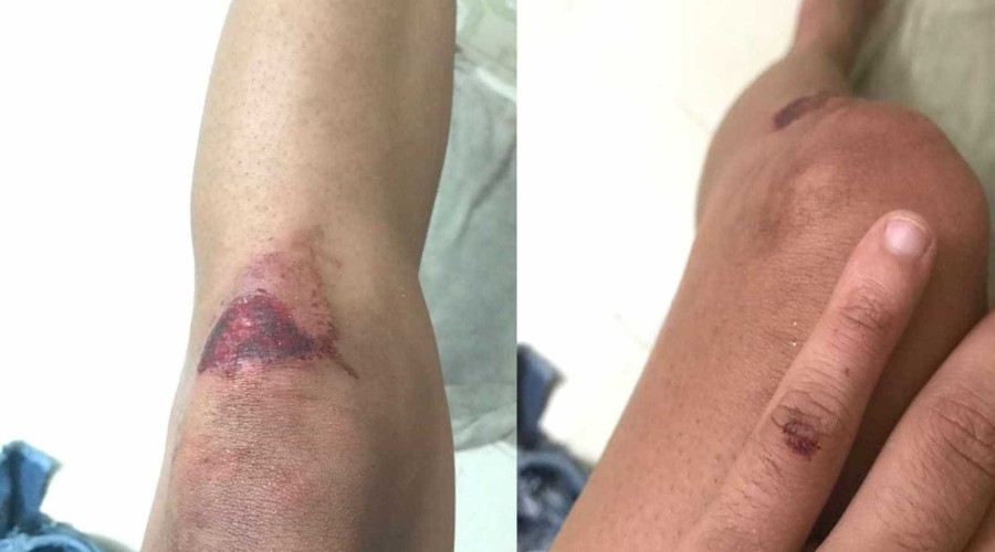 Transexual denuncia agressões em show de Wesley Safadão
