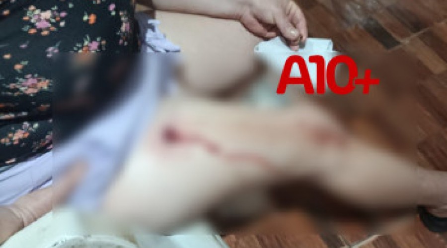 Briga entre vizinhos termina com mulher baleada no interior do Piauí; suspeito foi preso