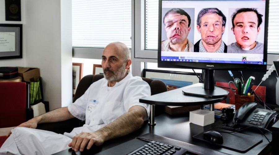 Homem dos três rostos fala sobre nova identidade após transplante