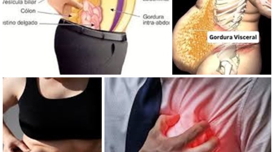 Saúde: Gordura abdominal invisível aumenta risco de infarto, aponta pesquisa