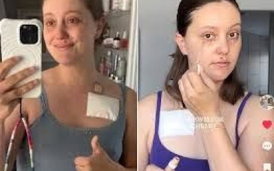 Mulher finge ter câncer de pâncreas e arrecada R$ 100 mil