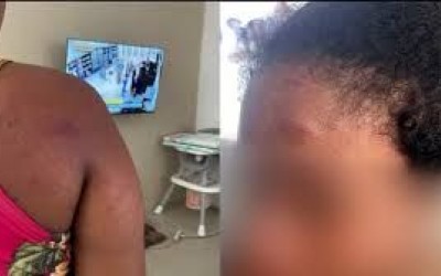Polícia do MA investiga agressão contra doméstica acusada de roubo por ex-patroa