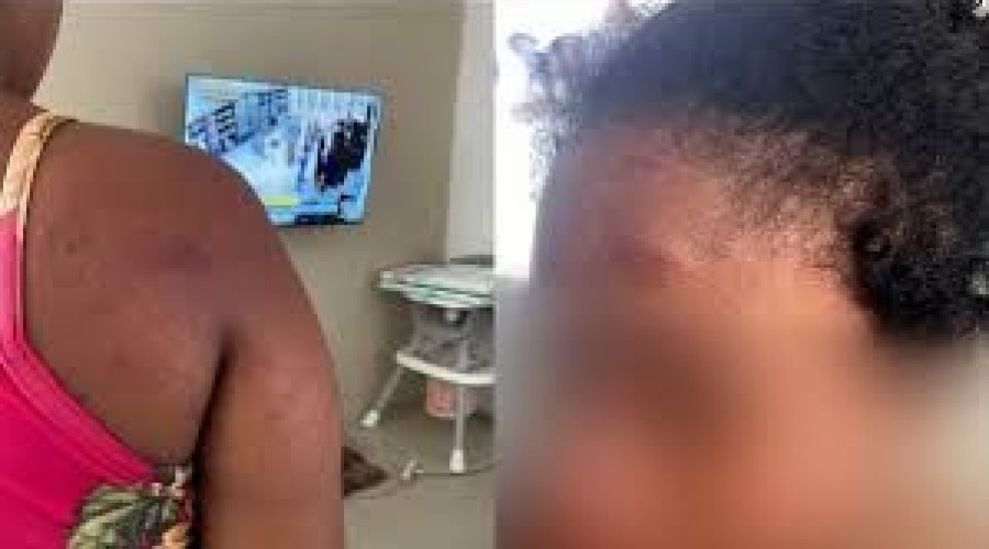 Polícia do MA investiga agressão contra doméstica acusada de roubo por ex-patroa