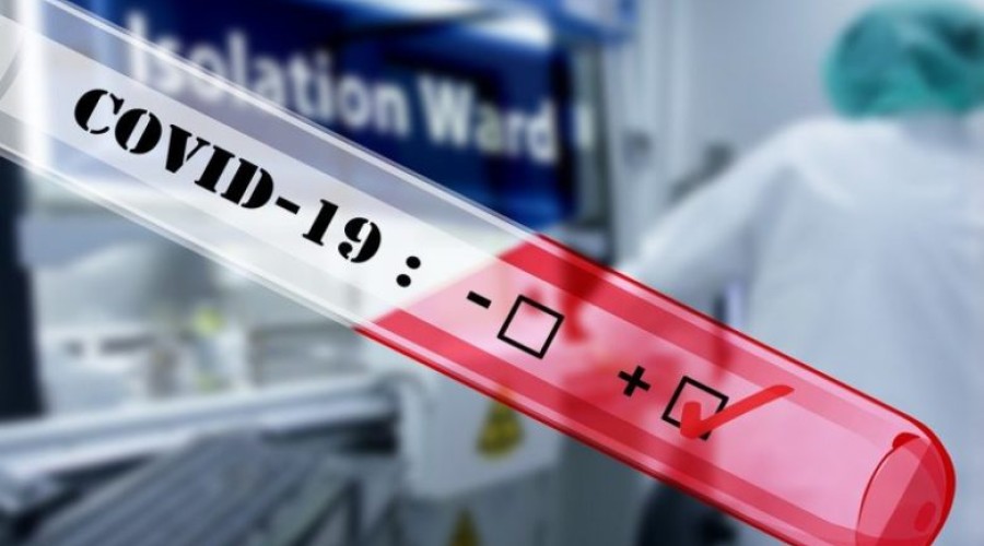 Mais de 90% dos novos casos de Covid-19 no Maranhão são registrados no interior
