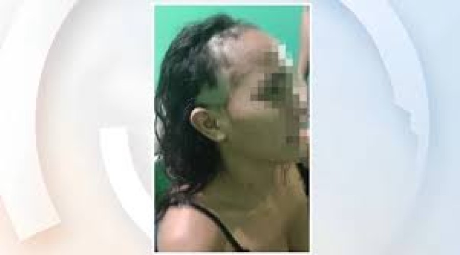 Mulher raspa o cabelo e simula agressão para denunciar o companheiro