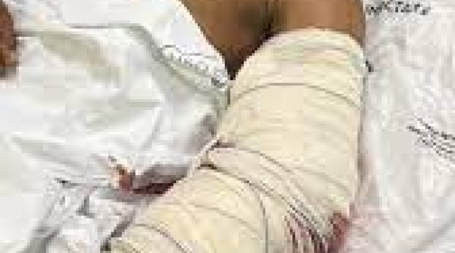 Suspeito de assassinato é baleado e preso dentro de hospital, no Maranhão