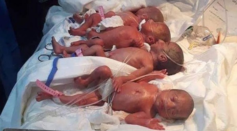 Veja: A mulher dá a luz a 7 bebês, impressionante!