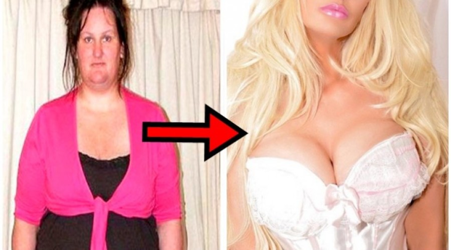 Ela perdeu 76 quilos e agora é chamada de Pamela Anderson; veja as fotos