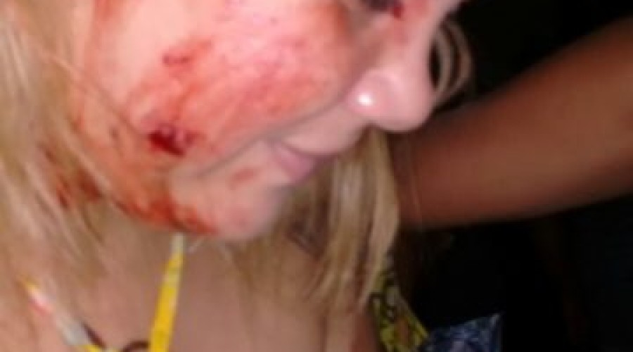 Procurador do município de Santa Luzia desfere pontapés no rosto de mulher