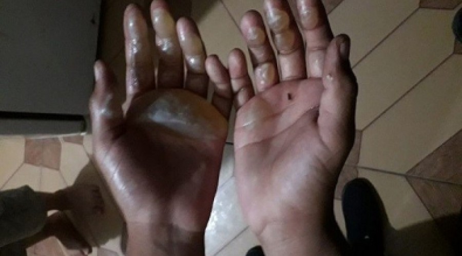 DESNATURADO - Pai esmaga dedos do próprio filho e coloca fita na boca para ele não gritar em MT