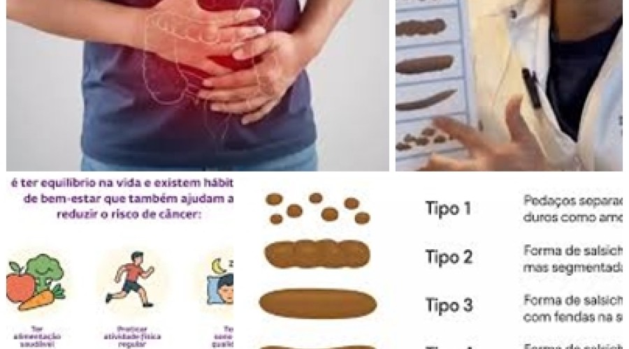 Dica de Saúde: Terceiro câncer que mais mata pode ser prevenido com simples hábito...