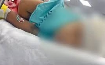 Olinda Nova: Bebê de apenas um ano é baleado na cabeça em emboscada no Maranhão; vítima não resistiu