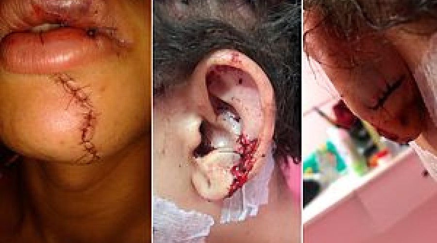 Quatro travestis são atacadas em dez dias na Pituba