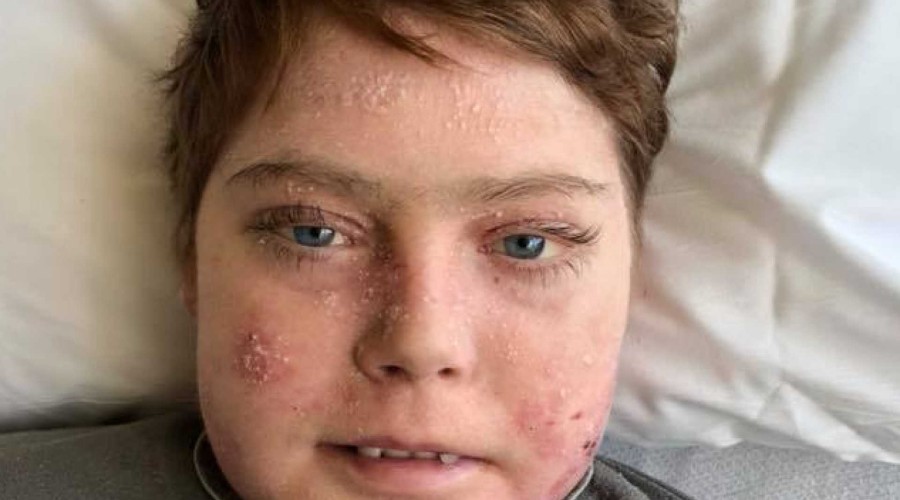Morreu Jonathan Pitre, a 
