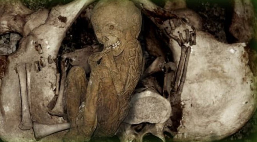 Nascimento de caixão: Saiba o que é extrusão fetal após a morte