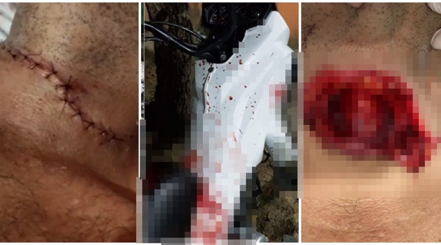 Imagens fortes: Entregador é degolado por linha de pipa com cerol