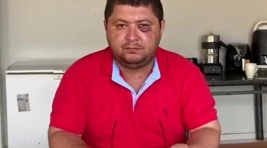 Veja os Vídeos: Professor carimba olho de vereador em Matões/MA…