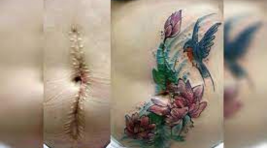 Veja algumas: Mulher faz tatuagens gratuitas em vítimas de agressão doméstica