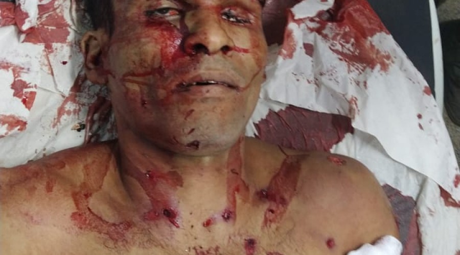 Assista o Vídeo: Lázaro Barbosa morre após troca de tiros com a polícia em Goiás, diz TV