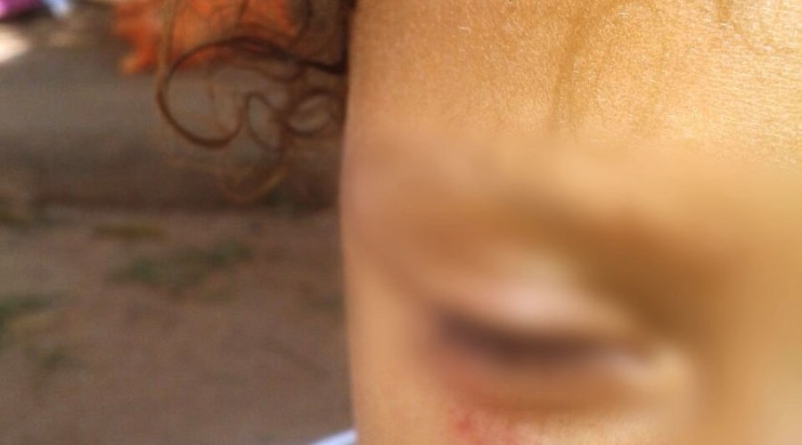Mulher é denunciada pela própria irmã por maltratar filha