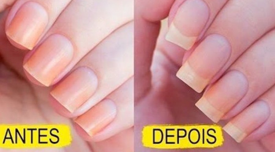 Dicas de Casa: Receita caseira para ter unhas firmes e fortes usando ingredientes que você tem no armário