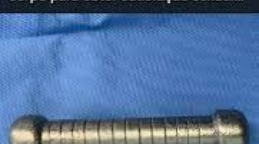 Obter satisfação sexual: Médicos encontram peso de academia de 2 quilos dentro de paciente