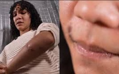 Violência Mulher trans vítima de agressões em Rosário relata trauma: 
