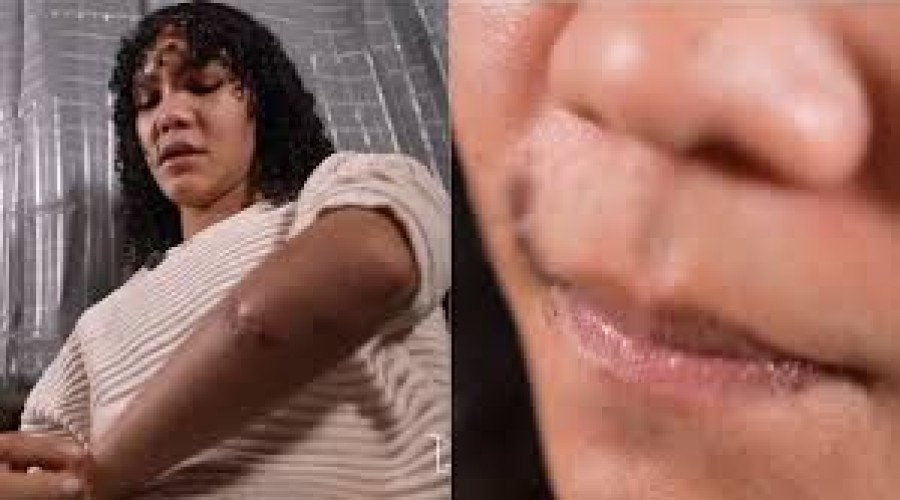 Violência Mulher trans vítima de agressões em Rosário relata trauma: 