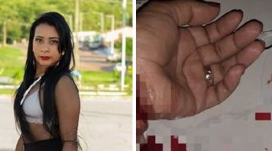 PM feminina que tentou suicídio passa por dificuldades em hospital em São Luís