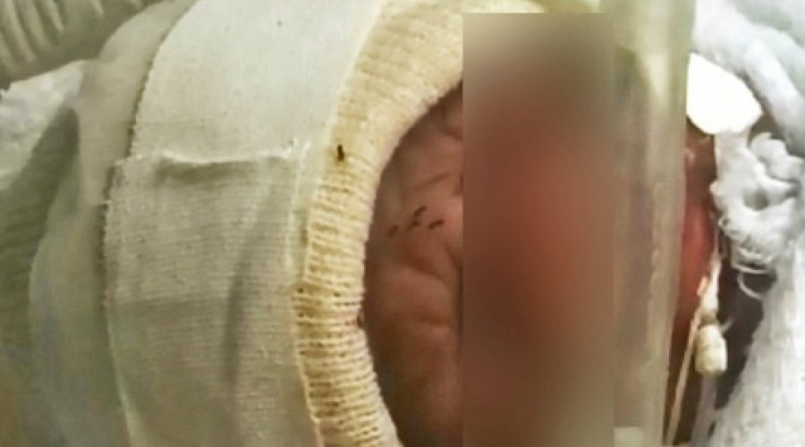 Assista ao Vídeo: formigas andam sobre rosto de bebê em maternidade de BH