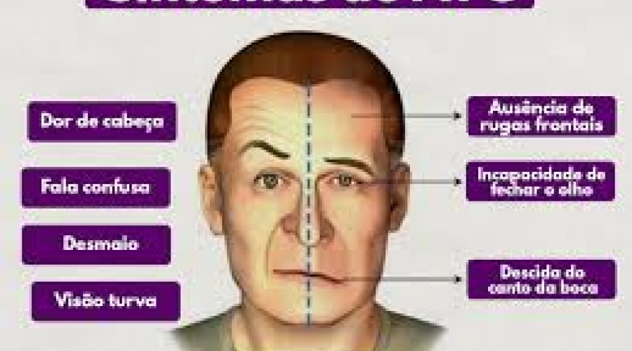Saúde - vídeo: Como saber se alguém está tendo - Quais são os sintomas do AVC? ou derrame.