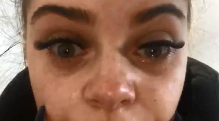 Mulher fica cega após colar cílios com cola preta