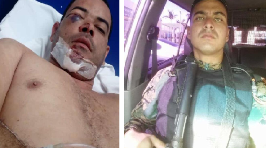Assista ao Vídeo: Em áudio, militar que agrediu funcionário público pede desculpas e apuração do caso