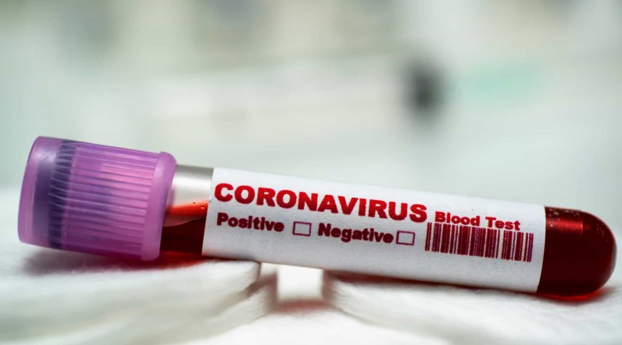 Brasil tem 1º resultado positivo para coronavírus