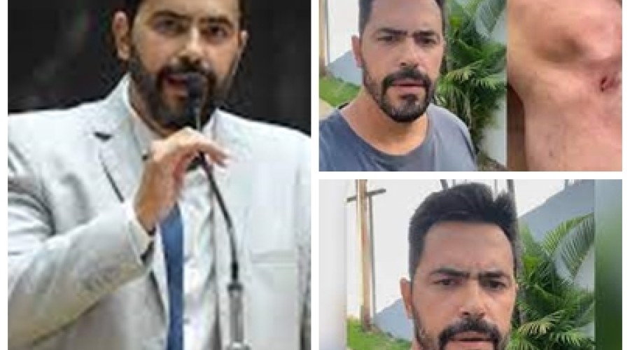 Deputado mineiro é assaltado e feito refém dentro de casa em MG; veja vídeo.