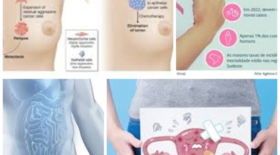 Saúde: O que é o câncer? - Principais tipos de câncer -Como o câncer é tratado?