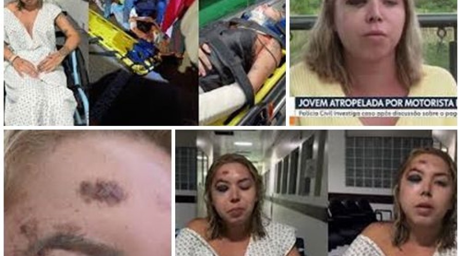Passageira é atropelada por motorista de app e fratura rosto em discussão sobre pagamento em SC