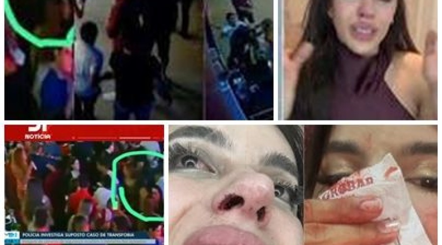 O que mostram as imagens analisadas pela polícia em caso de agressão denunciada como transfobia no MA