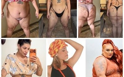 Ex-The Voice Aila Menezes mostra cicatriz após perder 90kg