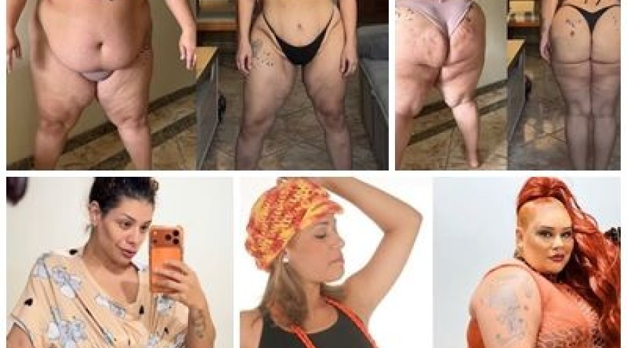 Ex-The Voice Aila Menezes mostra cicatriz após perder 90kg