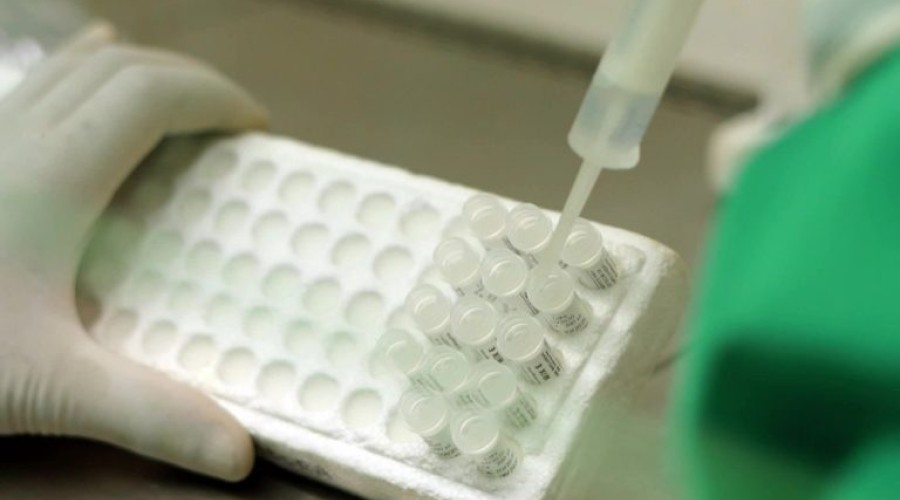 Japão desenvolve anticorpo que evita novas infecções da Covid-19