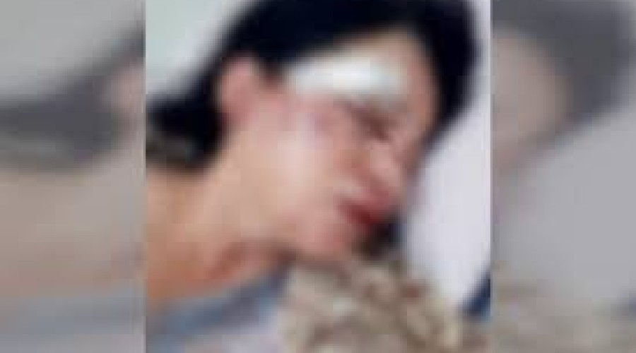 Mulher é espancada por vizinhos após festa ser denunciada por barulho