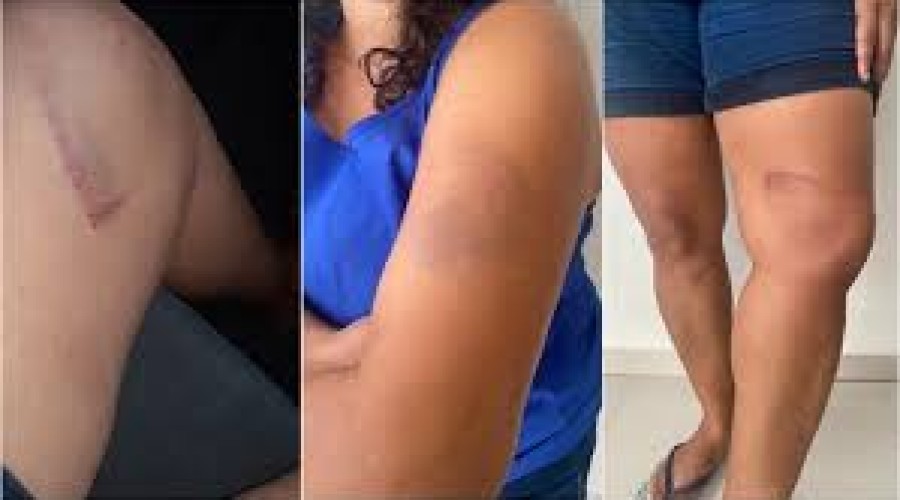 Justiça condena supermercado Mateus por tortura em cliente