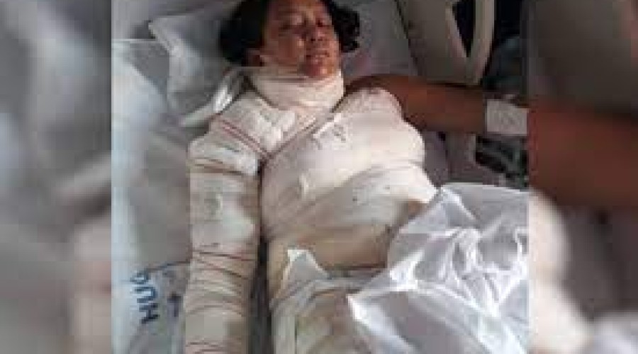 Sem dinheiro para comprar gás, jovem morre ao usar álcool para cozinhar