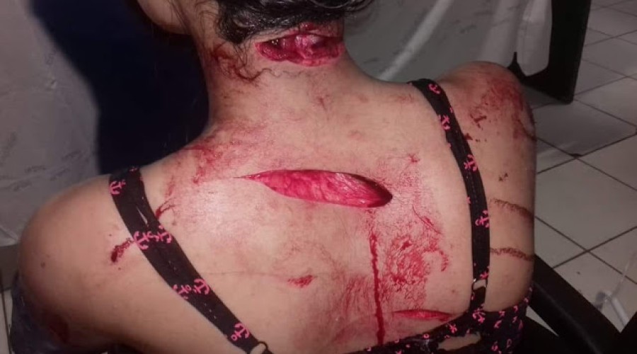 Mulher é esfaqueada em várias partes do corpo na frente de várias pessoas