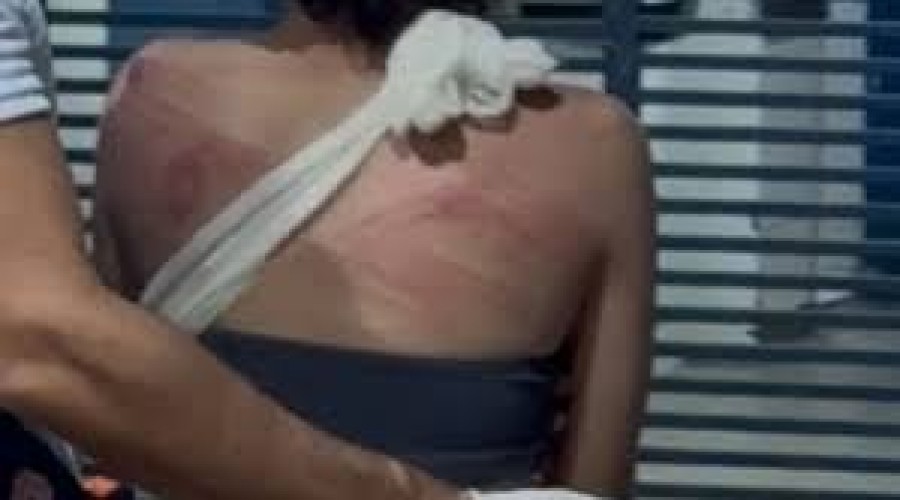 Imperatriz: Adolescente é atraída a cemitério e espancada por dupla,  vítima foi golpeada com um facão