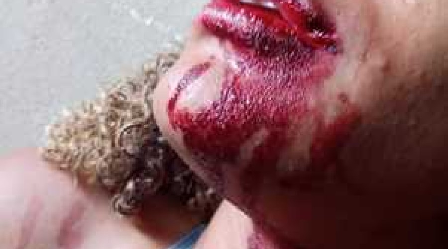 Sargento da PM dá soco na boca de mulher durante abordagem no DF