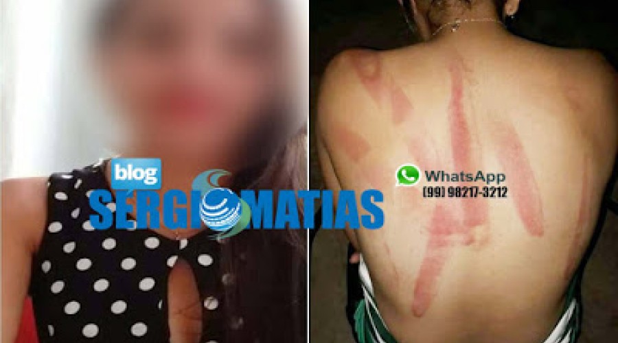 Mulher é agredida com panadas de fação pelo namorado enciumado