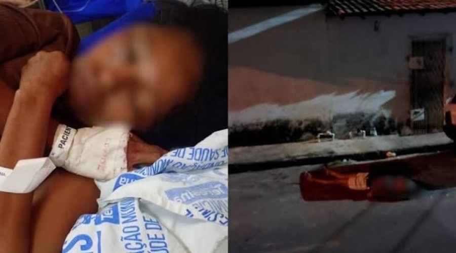 Mulher é brutalmente agredida pelo ex-companheiro após término em Timon; filha faz desabafo nas redes sociais