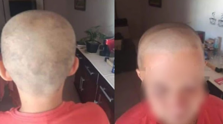 Maranhão: Ministério Público acompanha caso de criança que teve cabelo raspado em escola, em Vitorino Freire